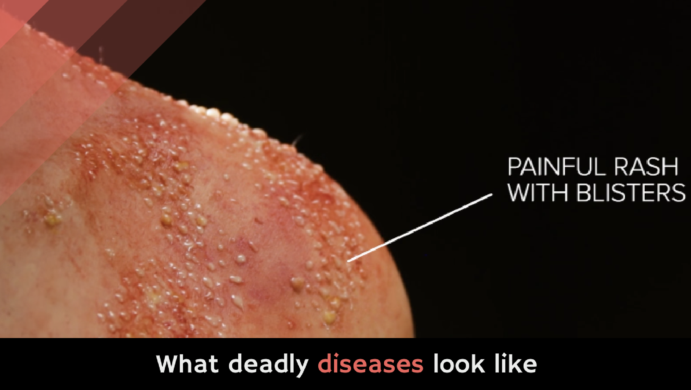 what-deadly-diseases-look-like-alltop-viral